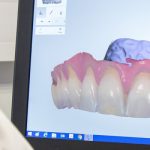 implantologia-digitale